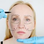 Surgeon for Your Facelift